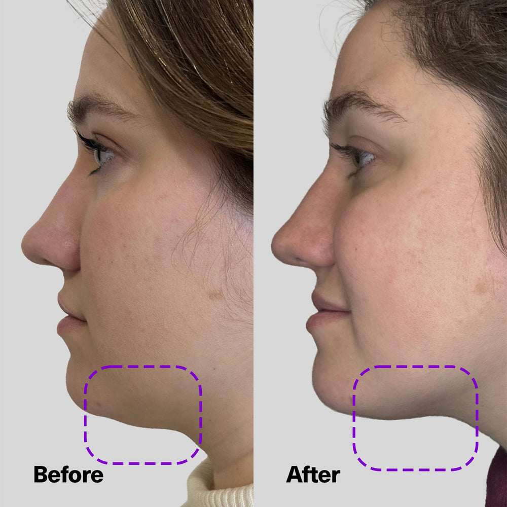 SickScience ShapeShift neck-application close-up demonstrates easy pump-on routine for daily use.