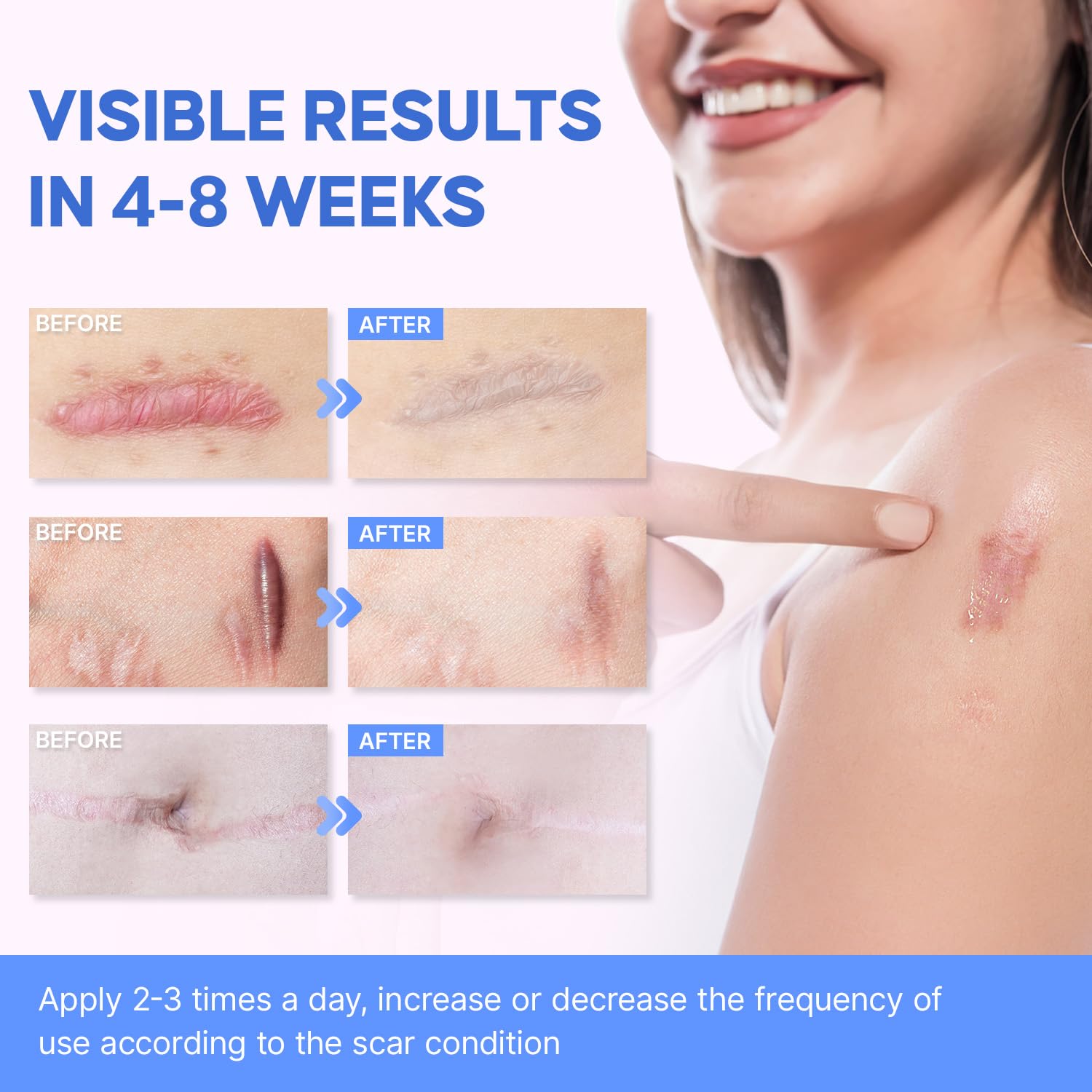 Sielkin scar sheets pair shown for comprehensive coverage