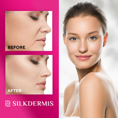SILKDERMIS silicone patch for smile lines closeup shows smoothing during wear.