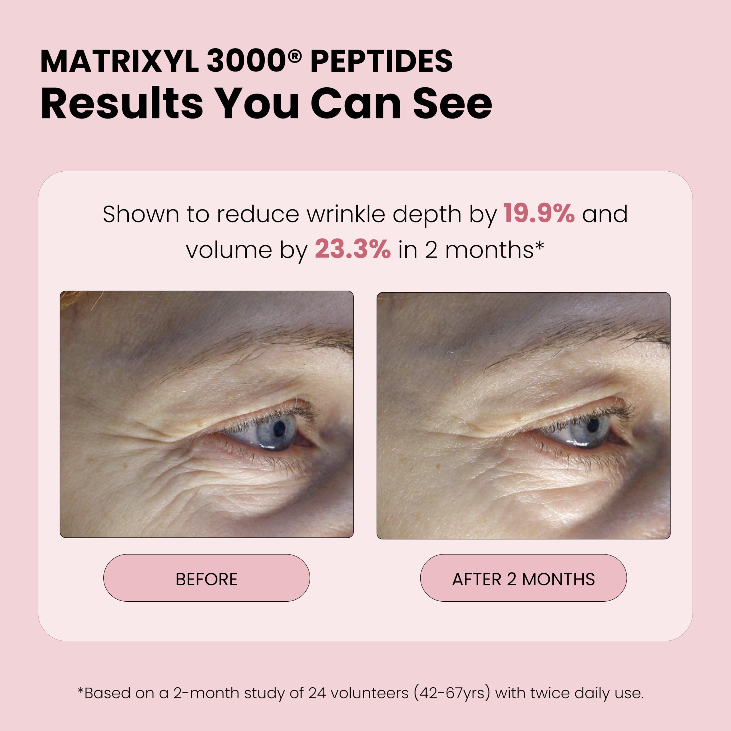Simplified Skin Matrixyl 3000 peptides icon close-up on label