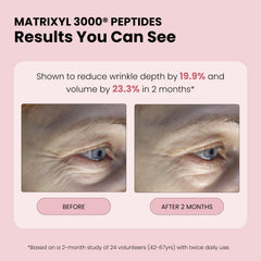 Simplified Skin Matrixyl 3000 peptides icon close-up on label