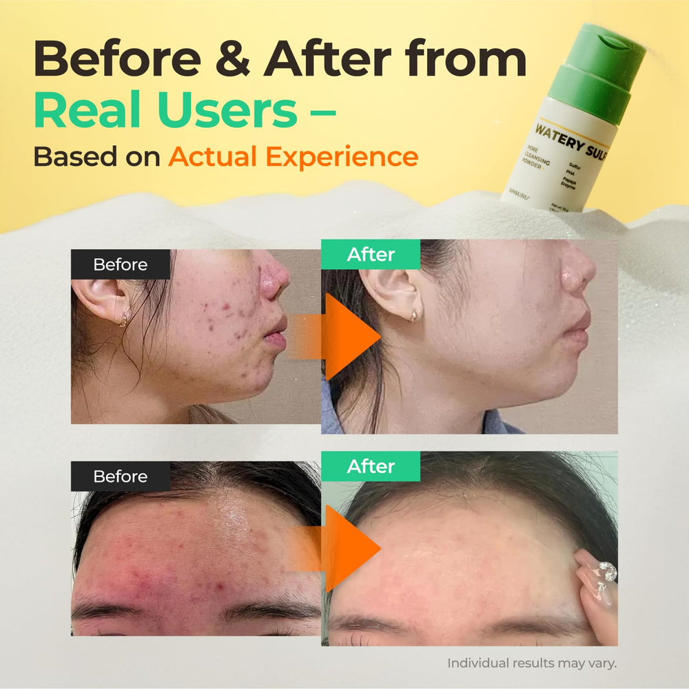 SINSURU Watery Sulfur Pore Cleansing Powder easy dispense pump in view