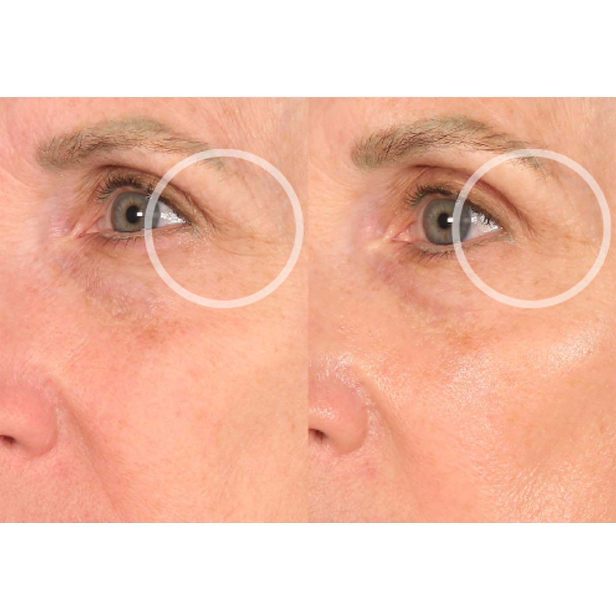 SiO Beauty FaceLift packaging box signaling reusable patch concept.