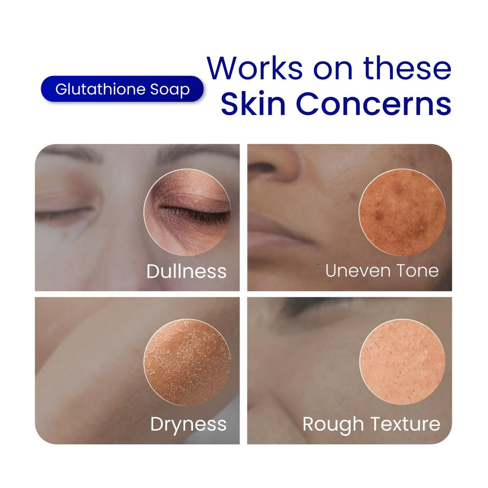 Skin Science Glutathione soap bars as part of a holiday gift set display.