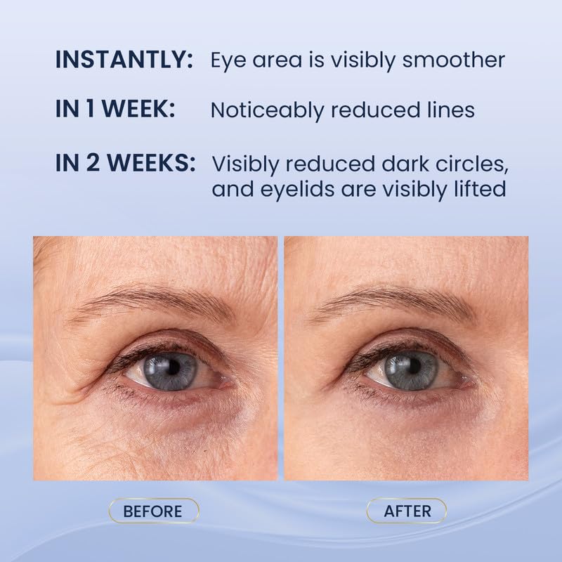 SKIN ULTIMA Dual Eye Cream lower eye cream smooths under-eye skin and reduces puffiness.