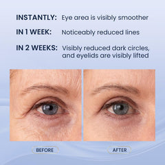 SKIN ULTIMA Dual Eye Cream lower eye cream smooths under-eye skin and reduces puffiness.