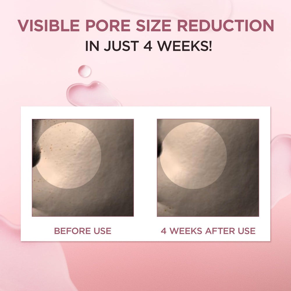 SKIN1004 Ampoule on oily skin with balanced sebum and clearer look