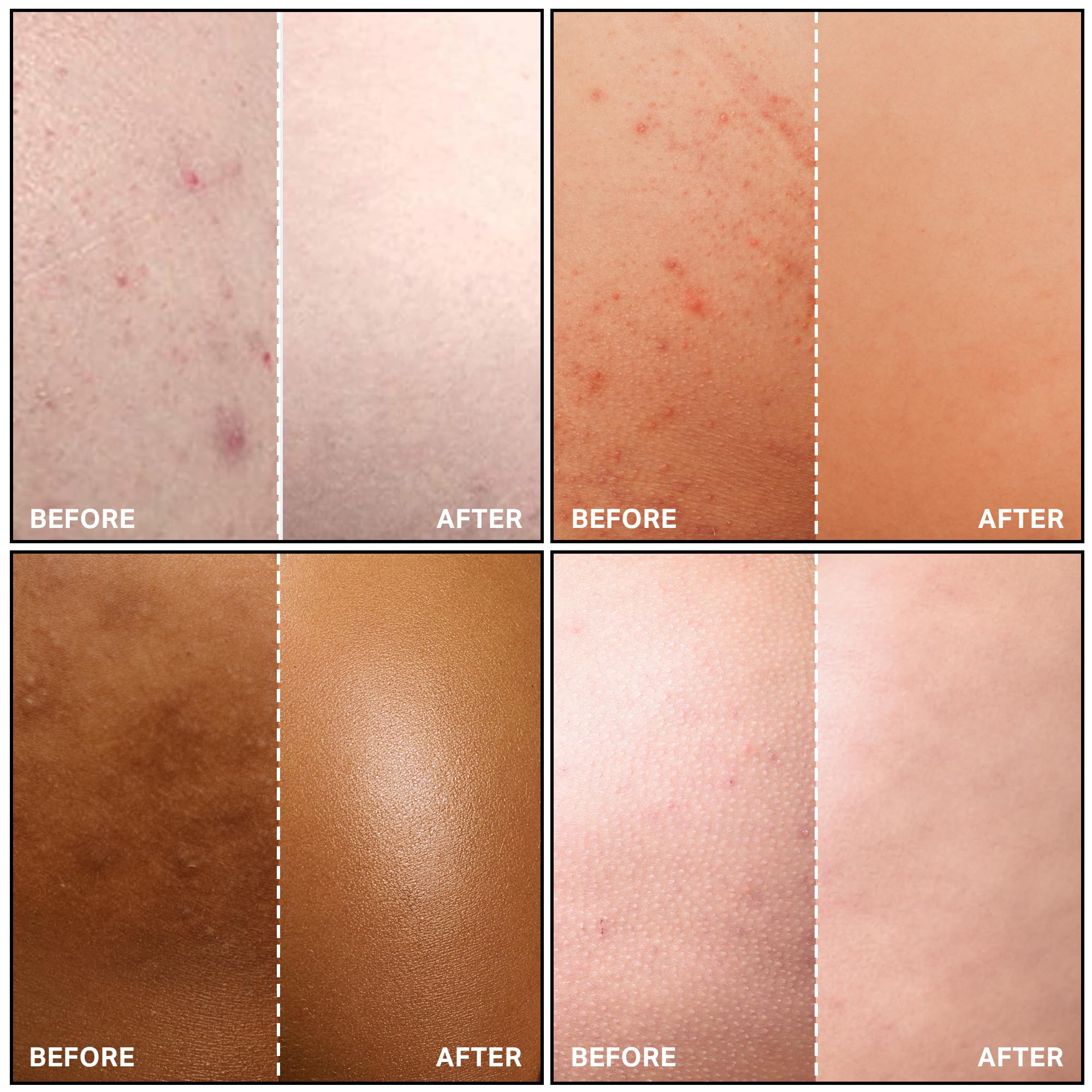 SKINBOSS fast-drying formula leaves no sticky residue after application