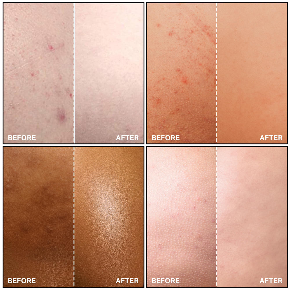 SKINBOSS fast-drying formula leaves no sticky residue after application