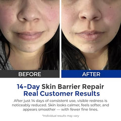 SKINERSE Intensive Repair Serum dropper closeup emphasizes controlled dispensing and soothing hydration
