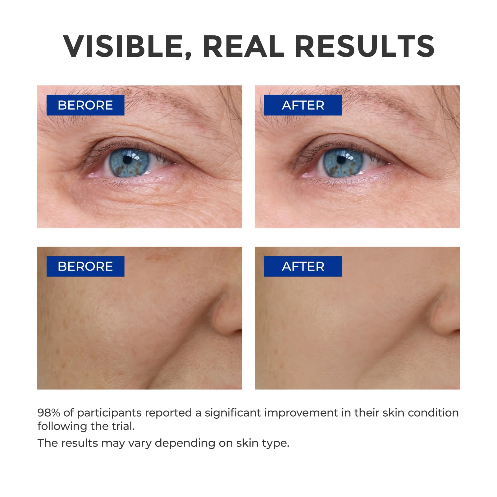 SKINERSE vitamin E and peptides bottle focus for anti-aging care.