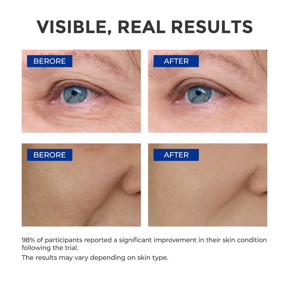 SKINERSE vitamin E and peptides bottle focus for anti-aging care.