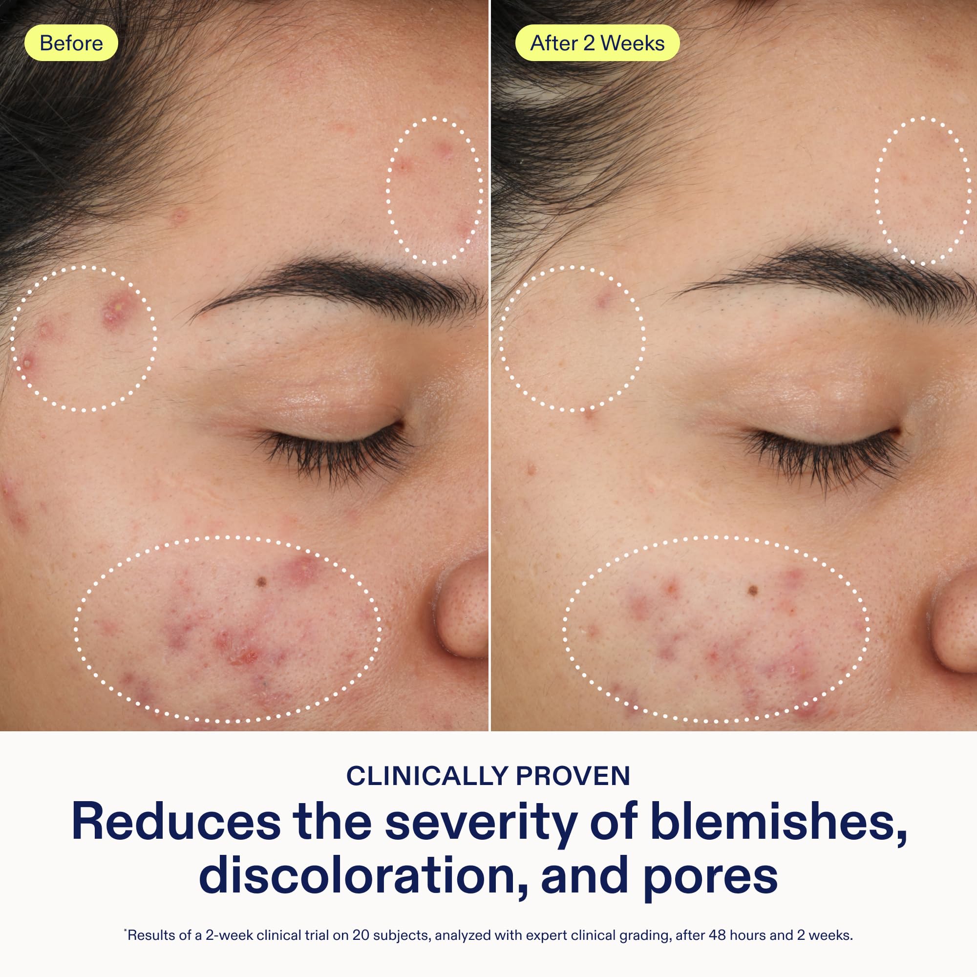 Skinfix 2% BHA Cleanser ingredients-glycolic-acid smooths texture for clearer skin.