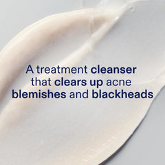Skinfix 2% BHA Cleanser ingredients-salicylic-acid targets blemishes and unclogs pores.
