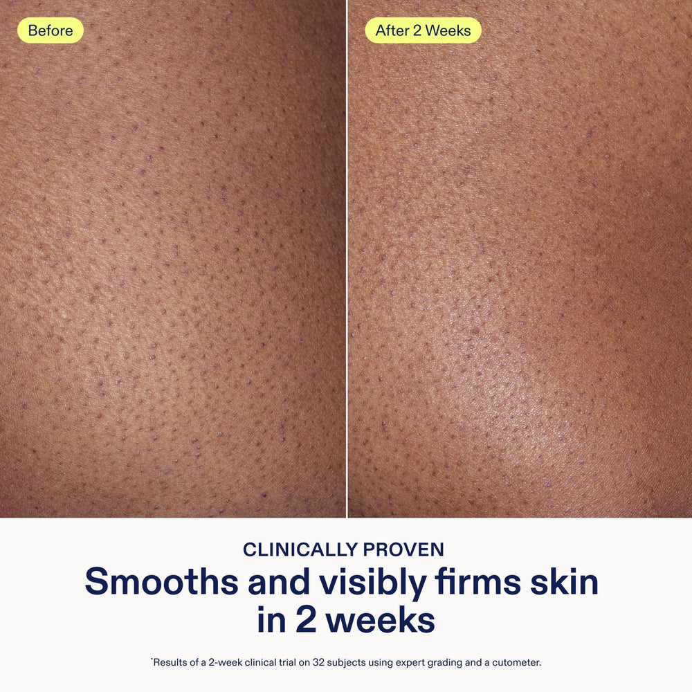 Applying Skinfix AHA/BHA Renewing Body Cream shows smoothing and hydration on skin.