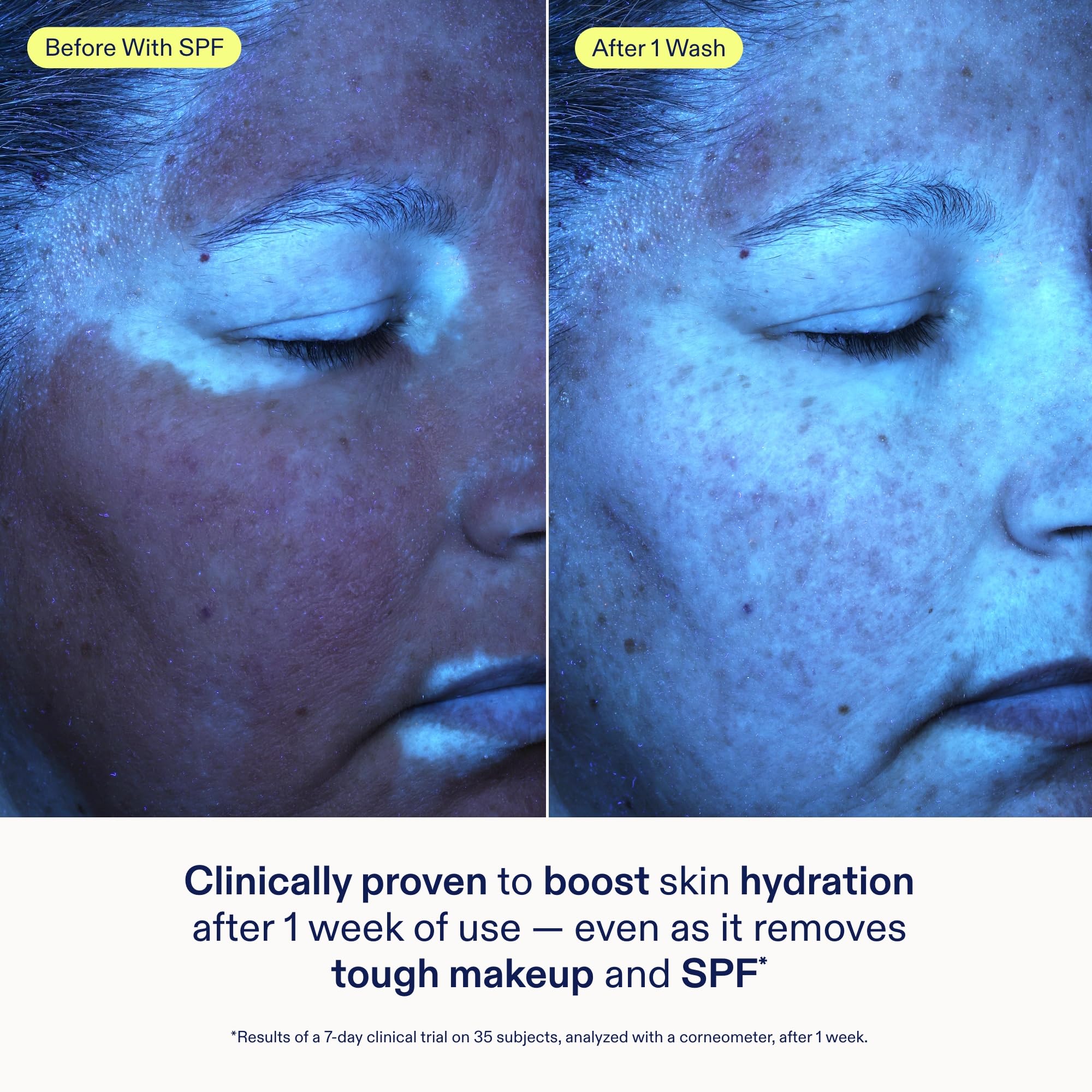Skinfix ceramide ectoin gel cleanser removes makeup and SPF residue.
