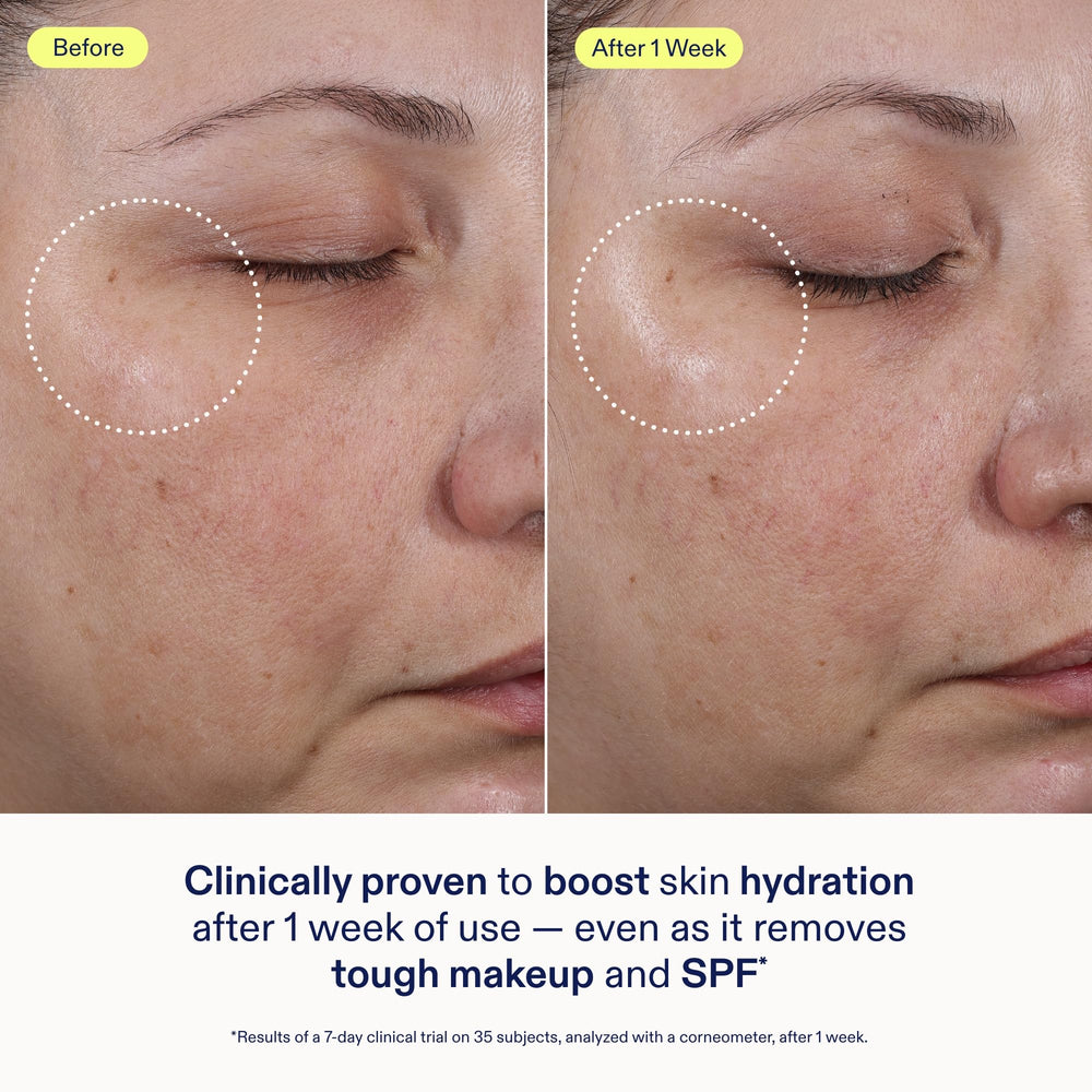 Skinfix ceramide ectoin gel cleanser removes SPF residue without stripping.