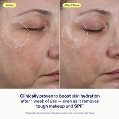 Skinfix ceramide ectoin gel cleanser removes SPF residue without stripping.