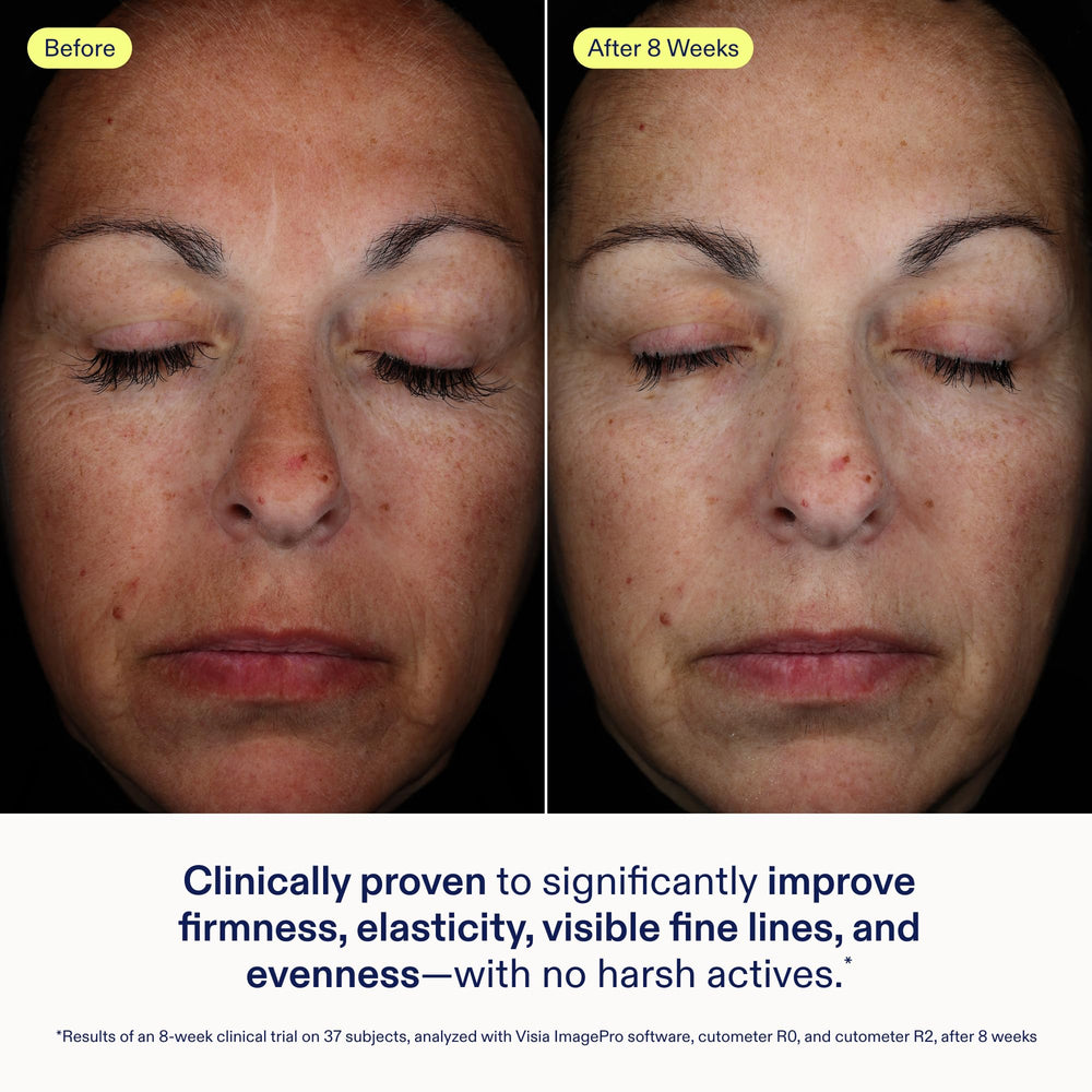 Silky balm texture of Skinfix Exo + Ectoin Intensive Repair Baume on skin for smoothing