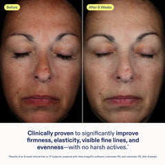 Silky balm texture of Skinfix Exo + Ectoin Intensive Repair Baume on skin for smoothing