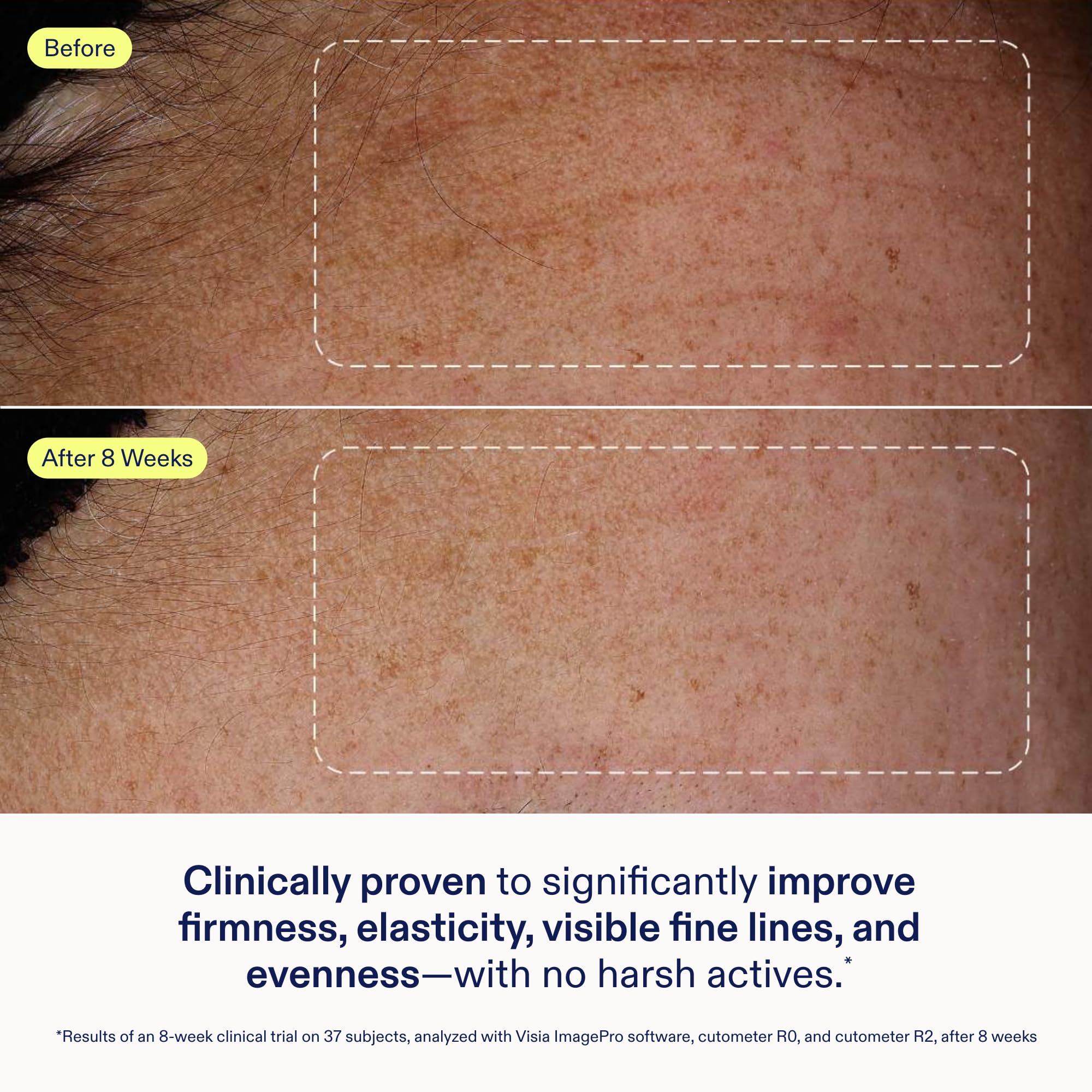Phyto Exosomes provide visible renewal in Skinfix Exo + Ectoin Baume