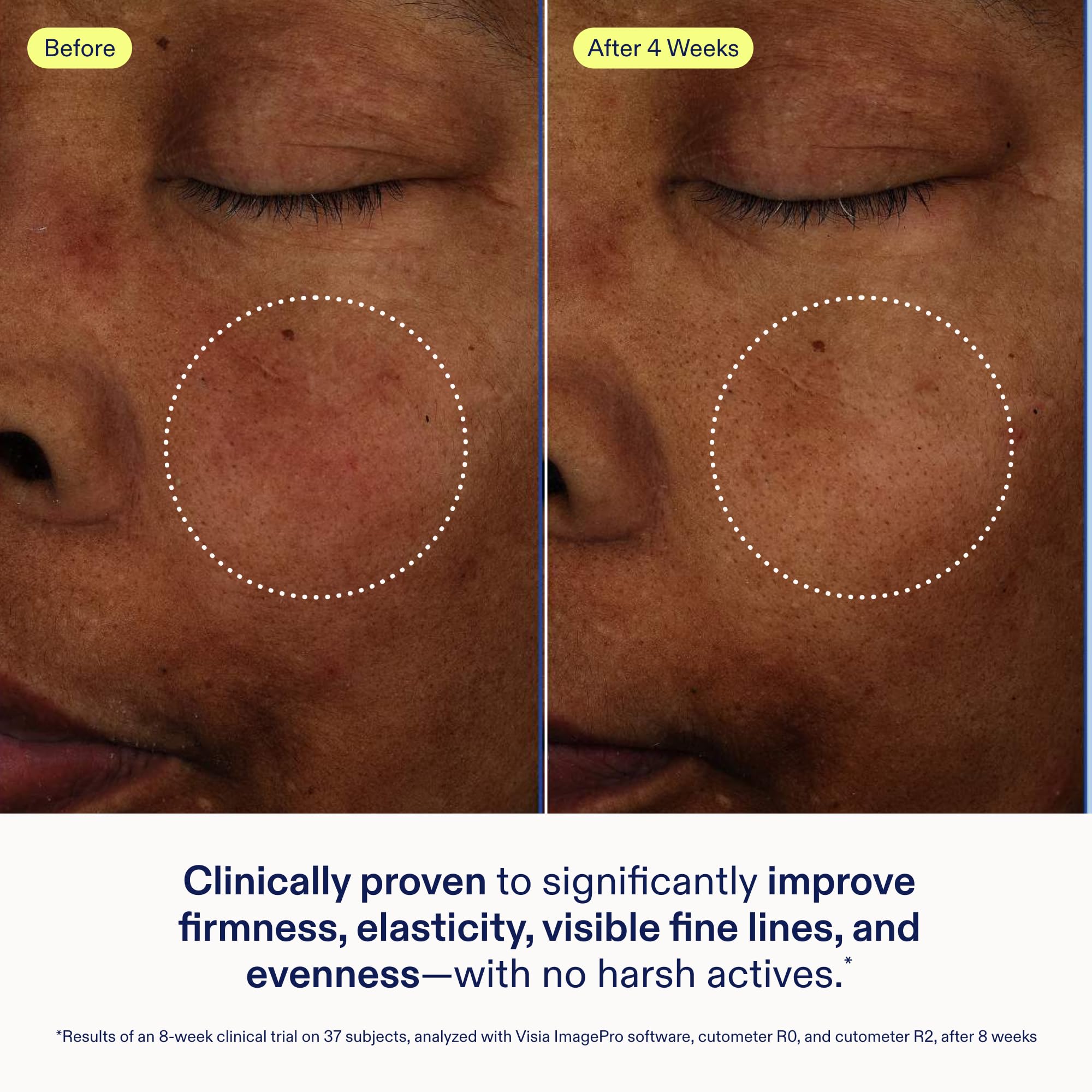 Recovery Complex soothes dry, depleted skin with Skinfix Exo + Ectoin Baume