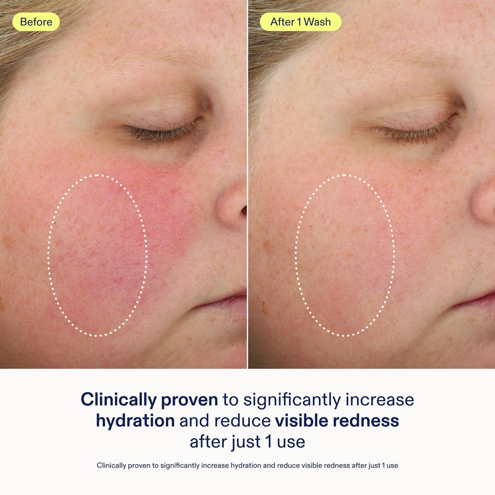 Skinfix Foaming Oil Cleanser gel-to-foam closeup shows hydrating lather without harsh residues.