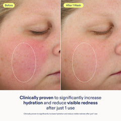 Skinfix Foaming Oil Cleanser gel-to-foam closeup shows hydrating lather without harsh residues.