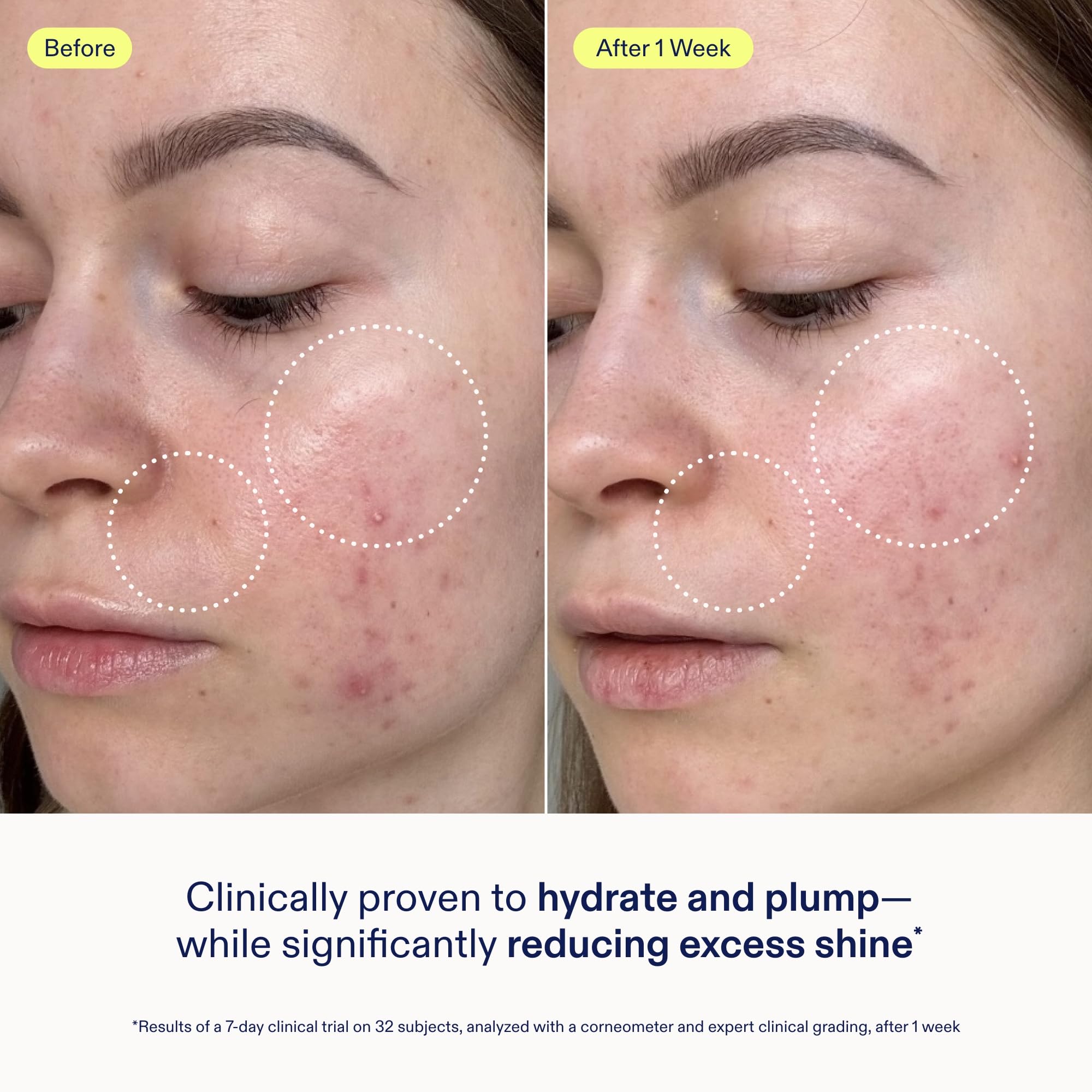Applying Skinfix Barrier Gel Cream to clean skin for hydration