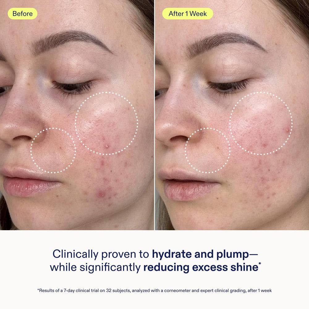 Applying Skinfix Barrier Gel Cream to clean skin for hydration