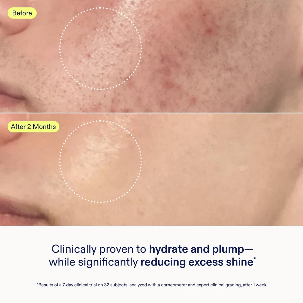 Skinfix Barrier Gel Cream leaving a dewy finish without greasiness