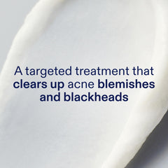 Skinfix spot-treatment applied directly on a pimple for targeted care