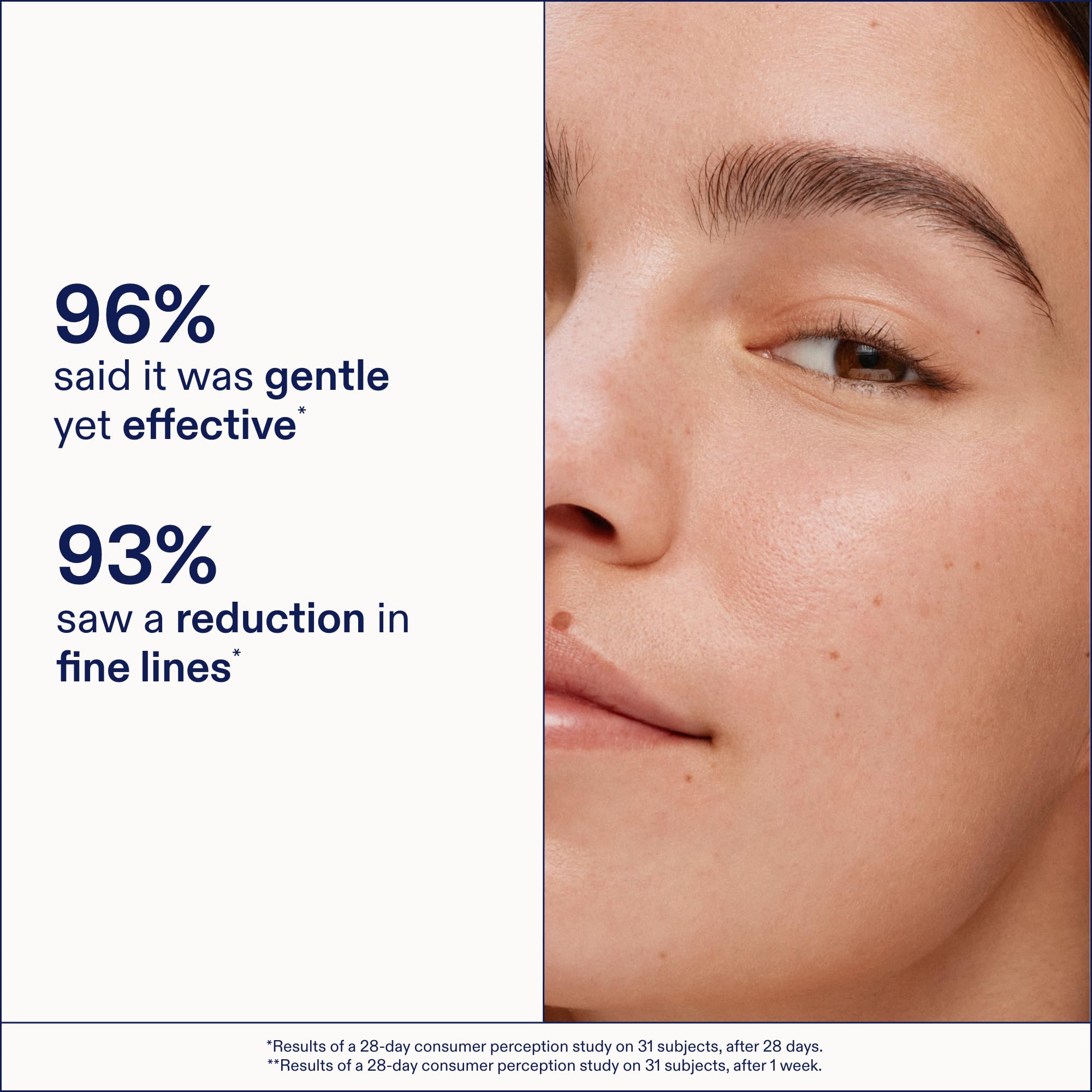 Skinfix Triple Lipid-Boost 360 Eye closeup shows smoother-looking under-eye lines.