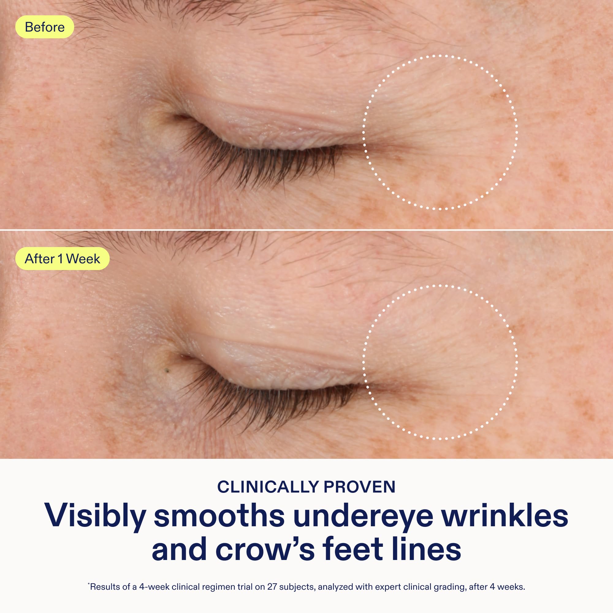 Skinfix Triple Lipid-Boost 360 Eye cream swatch reveals plump, dewy under-eye texture.
