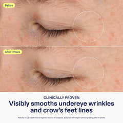Skinfix Triple Lipid-Boost 360 Eye cream swatch reveals plump, dewy under-eye texture.