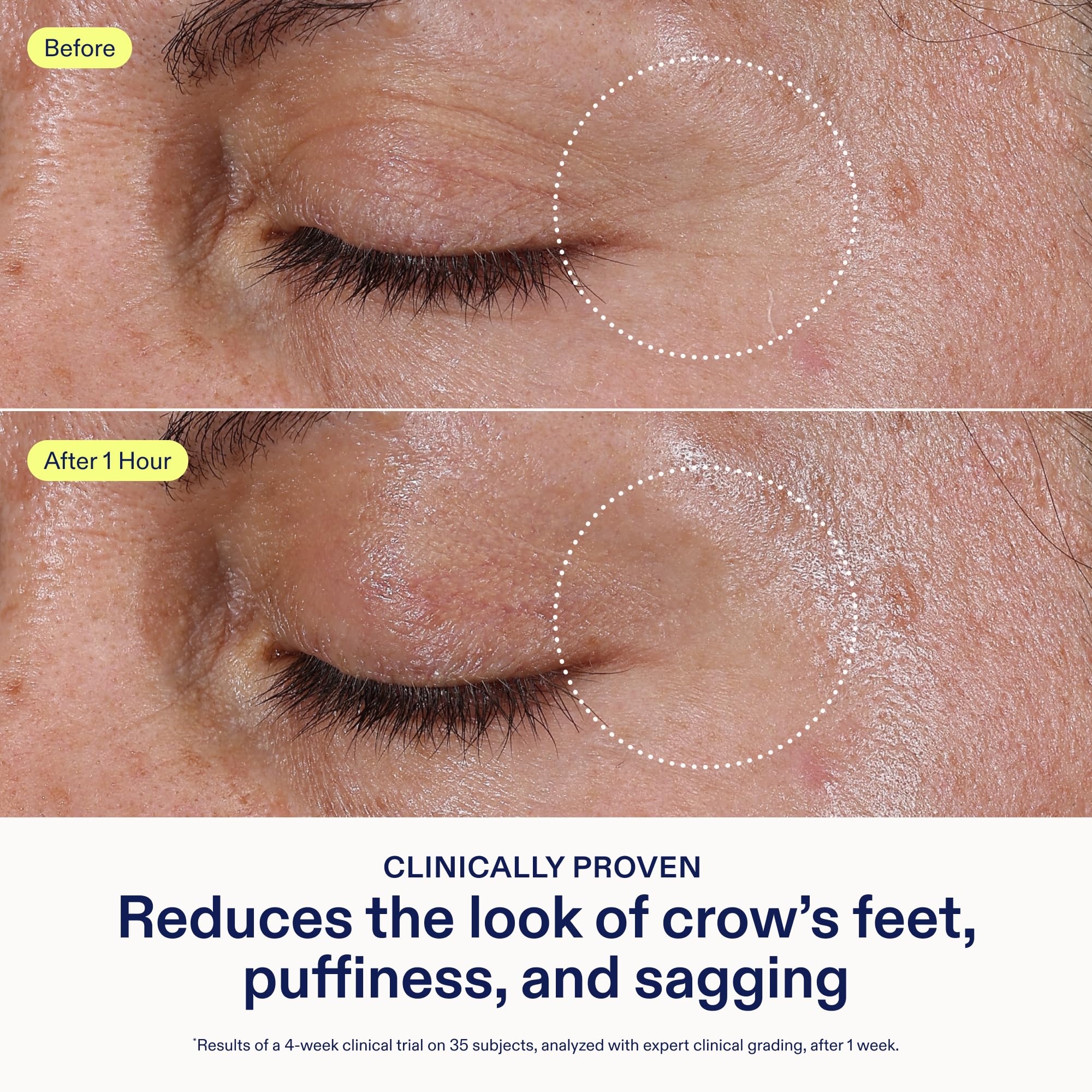 Skinfix Triple Lipid Eye Treatment tube close-up for precise under-eye application.