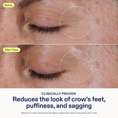 Skinfix Triple Lipid Eye Treatment tube close-up for precise under-eye application.