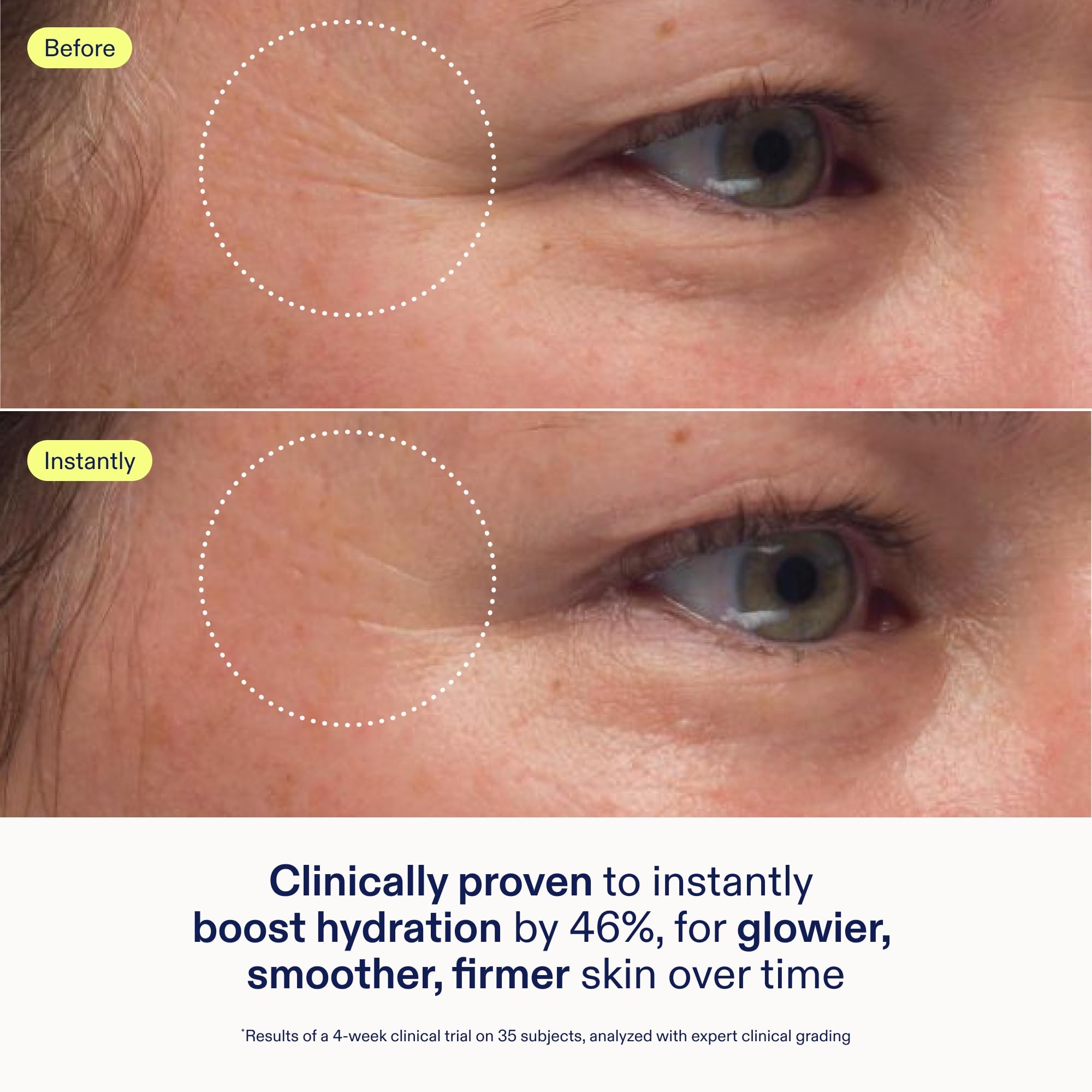 Skinfix triple lipid-peptide cream being spread on skin for dewy hydration.