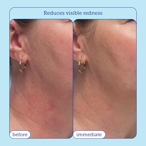 Skinfix triple lipid-peptide cream texture closeup – rich yet non-greasy finish.