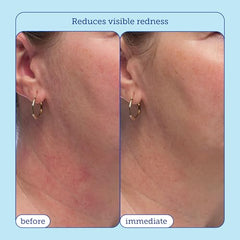 Close-up of Skinfix texture showing rich, non-greasy hydration.