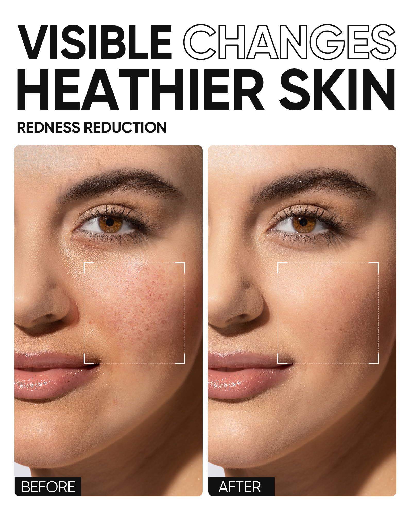 SKINTIFIC 5X Ceramides Centella soothing closeup for sensitive or compromised skin