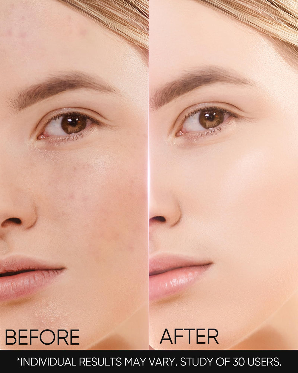 Skintific MSH Niacinamide Cream in daily routine setup for oil-prone skin