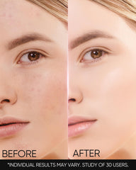Skintific MSH Niacinamide Cream in daily routine setup for oil-prone skin