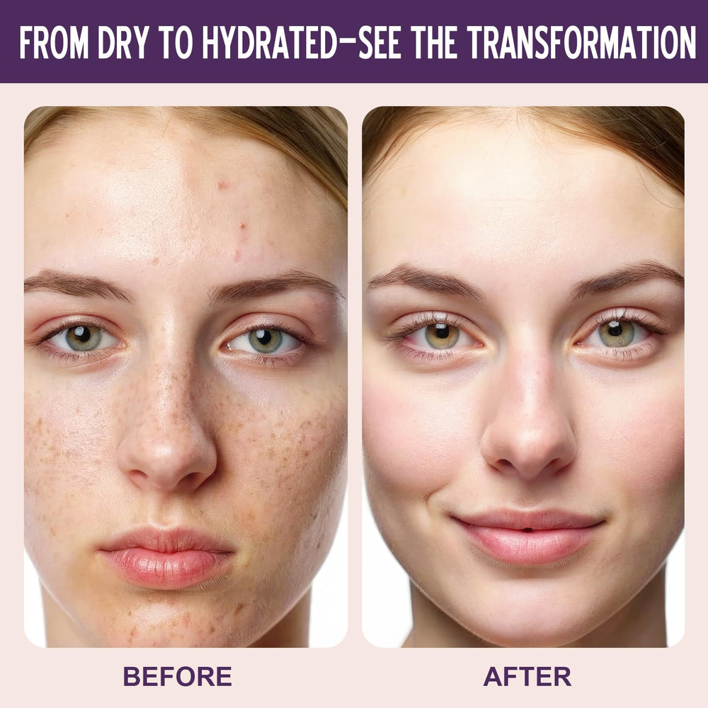 SKSOYT Helichrysum Balm packaging close-up emphasizes clean ingredients and premium feel.