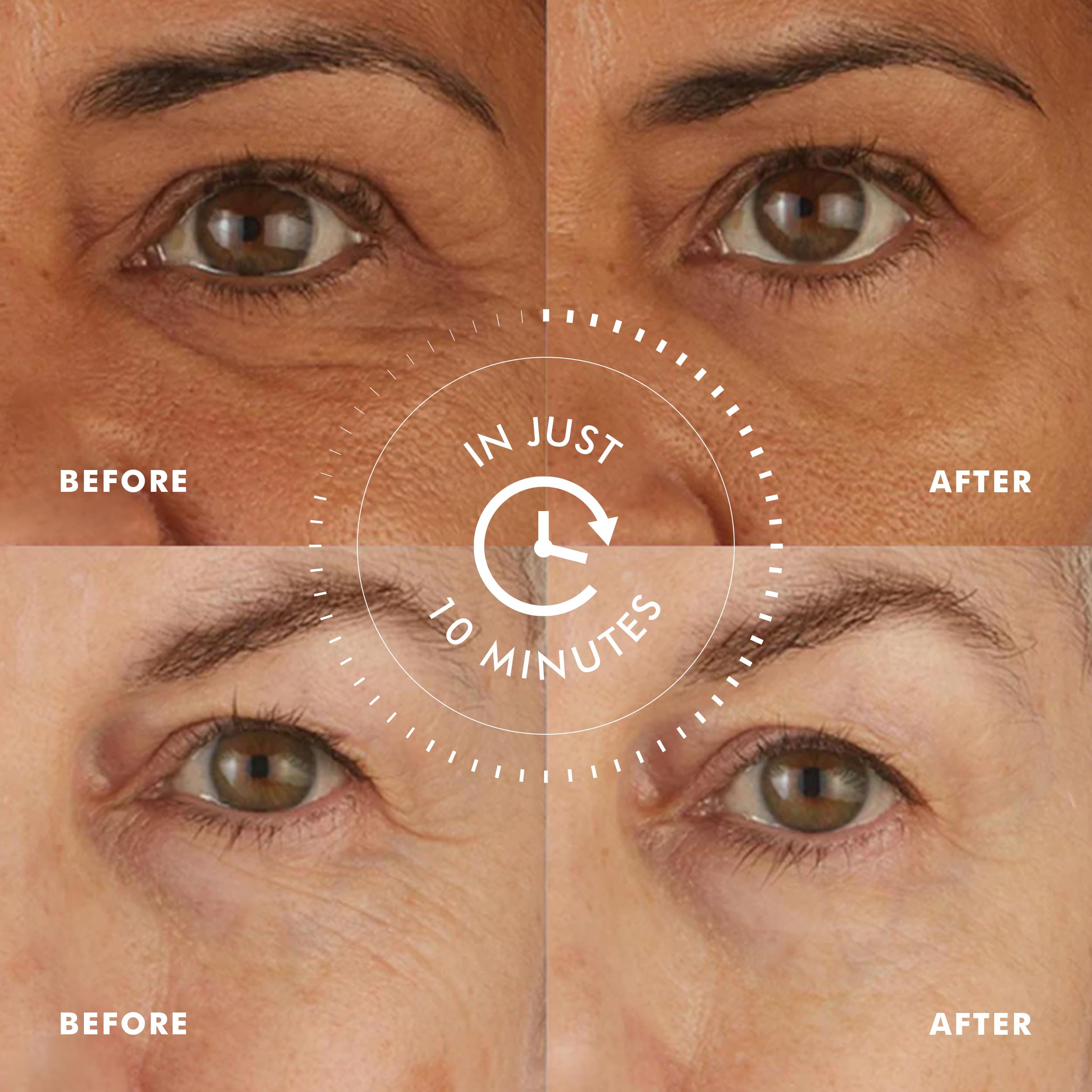 skyn iceland eye gel patches being applied for gentle under-eye firming