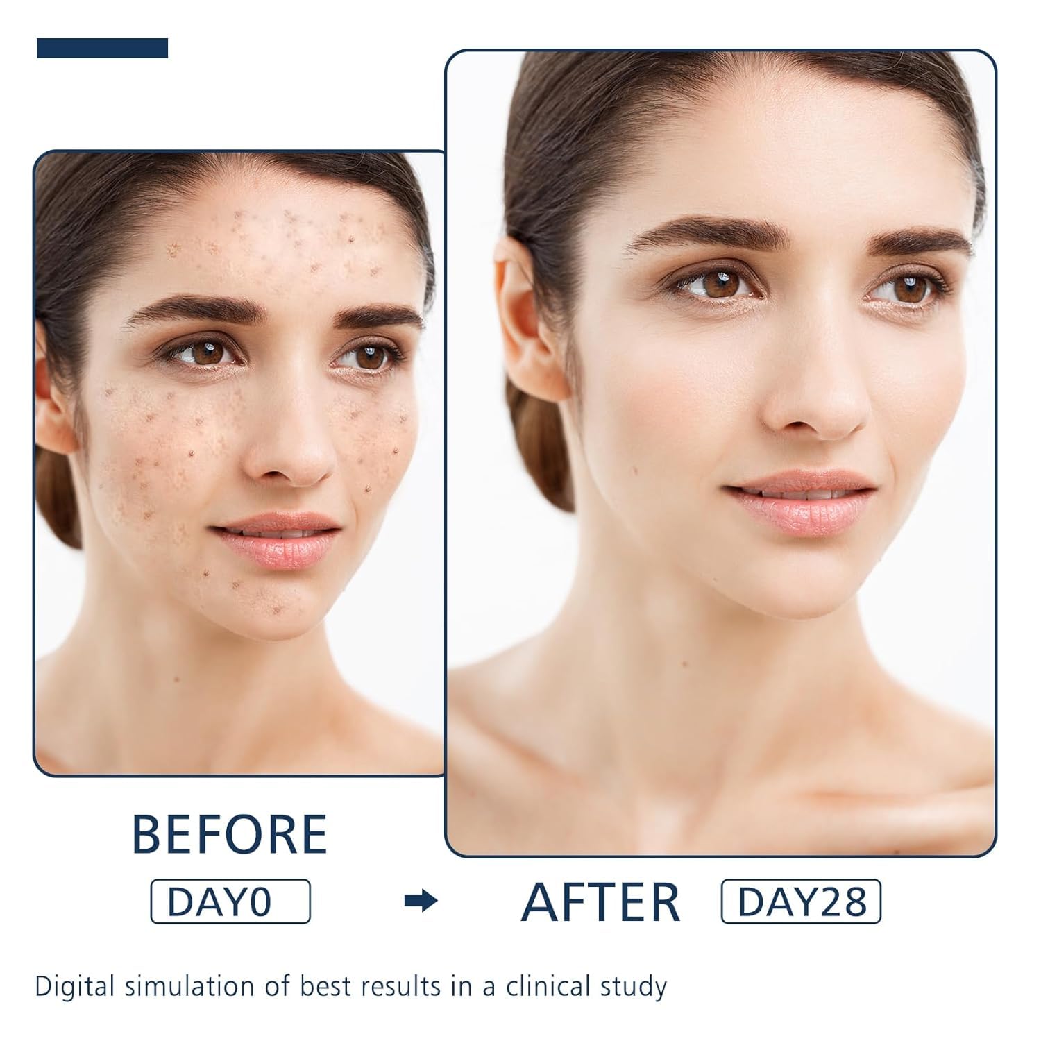 SNFAJOHE lightweight serum quickly absorbs with a non-greasy finish.