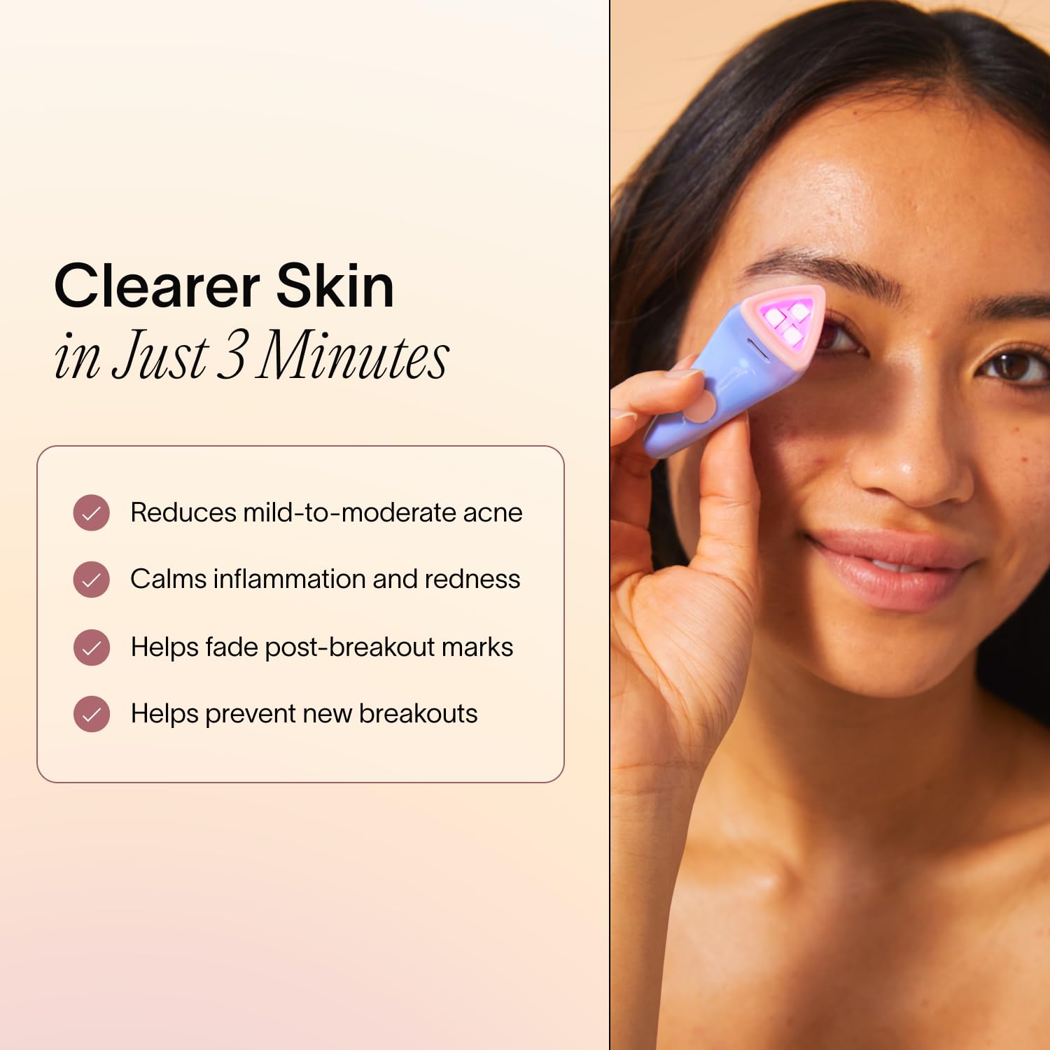 Solawave Bye Acne red-light therapy soothing redness and inflammation