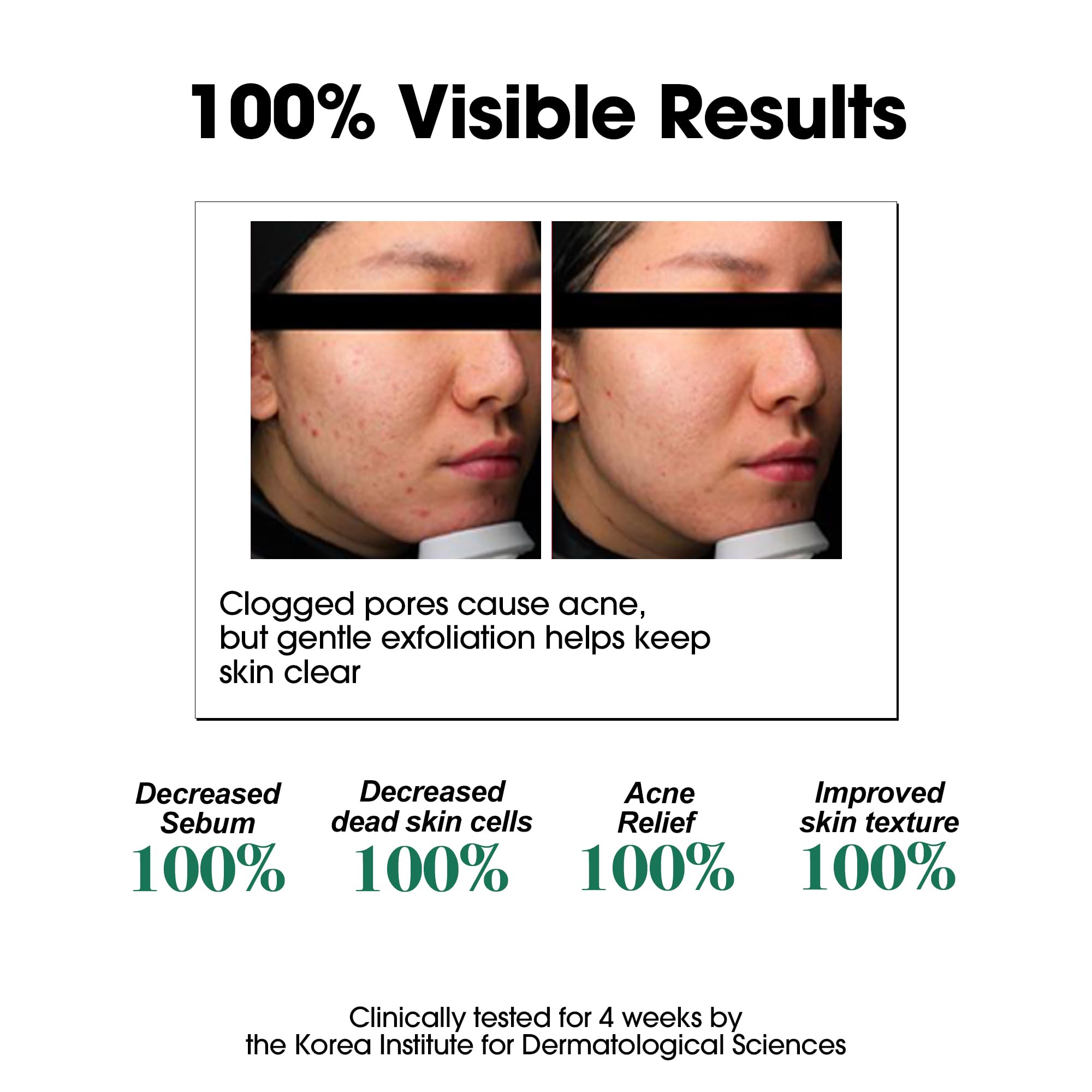 SOME BY MI bottle dispense-closeup shows precise application for gentle exfoliation.