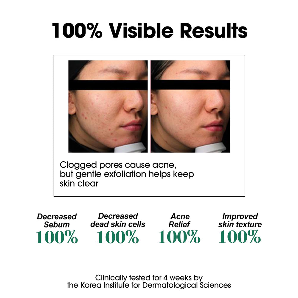 SOME BY MI bottle dispense-closeup shows precise application for gentle exfoliation.