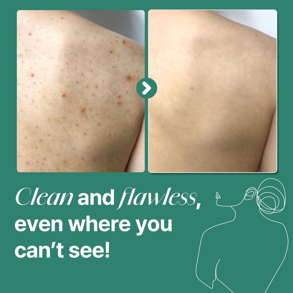 SOME BY MI dermatologically tested formula indicates suitability for sensitive skin.